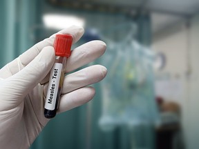 MEASLES: Are fewer new cases a sign of the outbreak’s end?