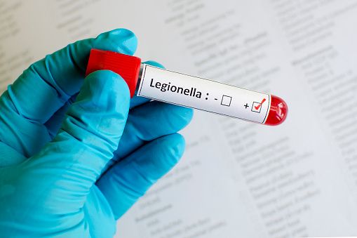 One dead in second outbreak of Legionnaires’ disease in London in two years