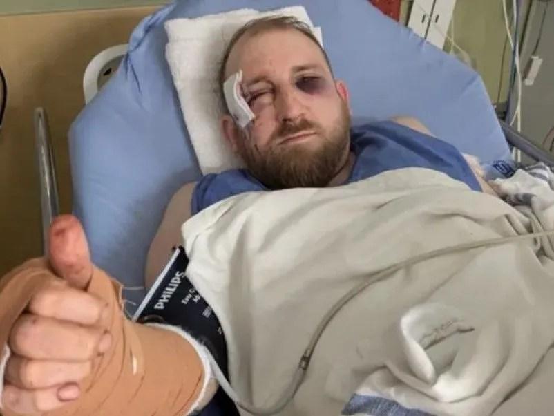 Chased, dragged out, beaten and stabbed: London man recounts traffic attack