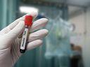 Measles cases drop to new low in Oxford, Elgin: ‘Cautiously encouraged’ Measles cases drop to new low in Oxford, Elgin: ‘Cautiously encouraged’